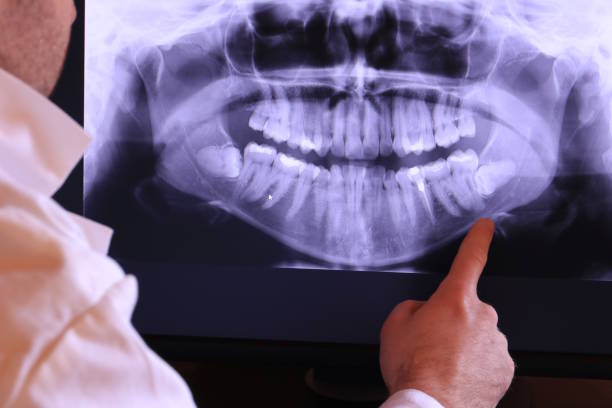 Best Emergency Treatment for Jaw Pain or Injury in Heceta Beach, OR